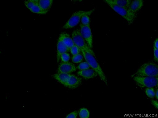 [15915-1-AP-150UL] VPS26B Polyclonal antibody