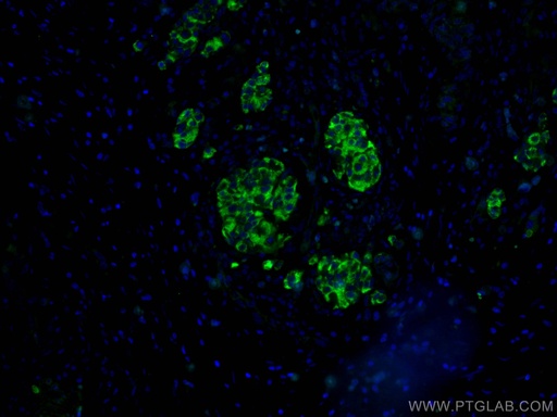 [15924-1-AP-150UL] RHEB Polyclonal antibody