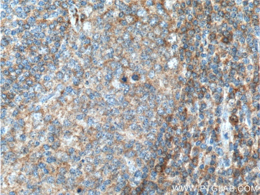 [15931-1-AP-20UL] ValRS Polyclonal antibody