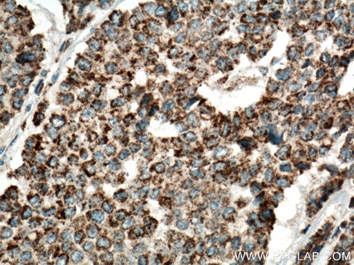 [15932-1-AP-150UL] IDH2 Polyclonal antibody