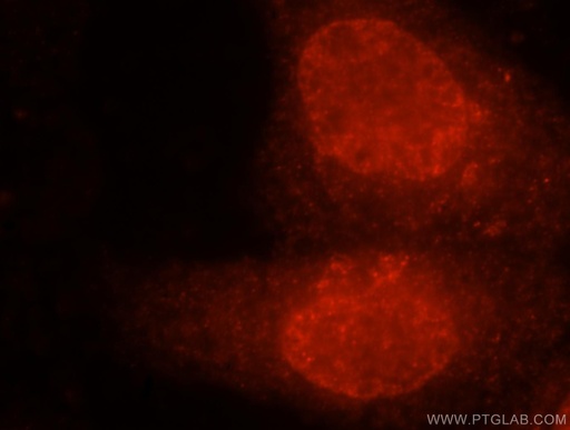 [15937-1-AP-150UL] EXOSC4 Polyclonal antibody