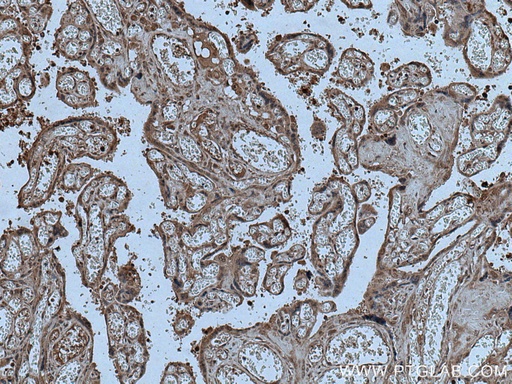 [15944-1-AP-20UL] CPZ Polyclonal antibody