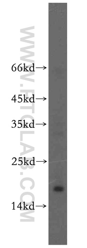[15950-1-AP-20UL] UTP23 Polyclonal antibody