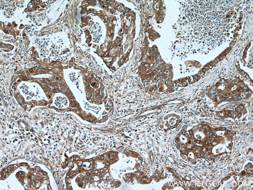 [15966-1-AP-20UL] UBR4 Polyclonal antibody