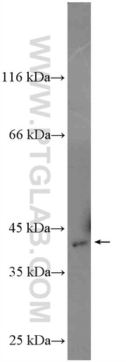 [15979-1-AP-20UL] Spermine synthase Polyclonal antibody