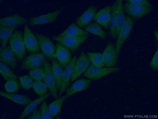 [15981-1-AP-20UL] ISG15 Polyclonal antibody