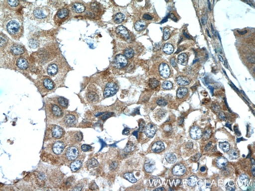 [16032-1-AP-20UL] CSN3 Polyclonal antibody