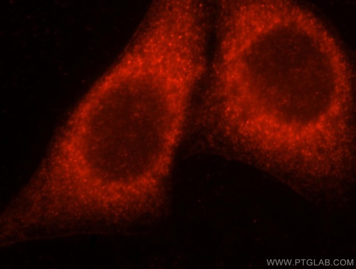 [16137-1-AP-20UL] CAB39L Polyclonal antibody