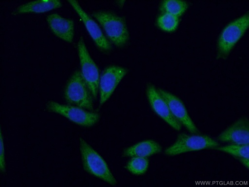 [16155-1-AP-20UL] KRAS-2B-specific Polyclonal antibody