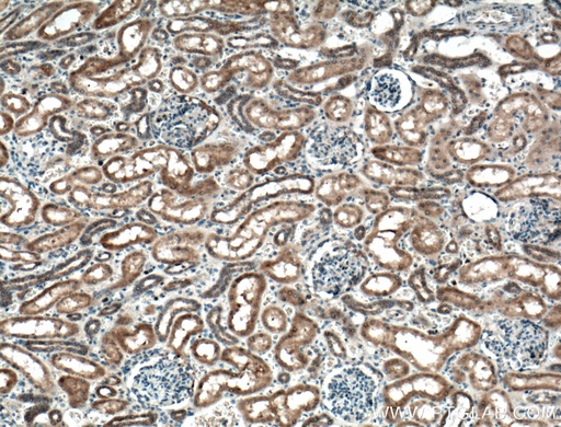 [16202-1-AP-150UL] PLEKHM1 Polyclonal antibody