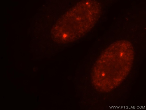 [16203-1-AP-20UL] TOE1 Polyclonal antibody