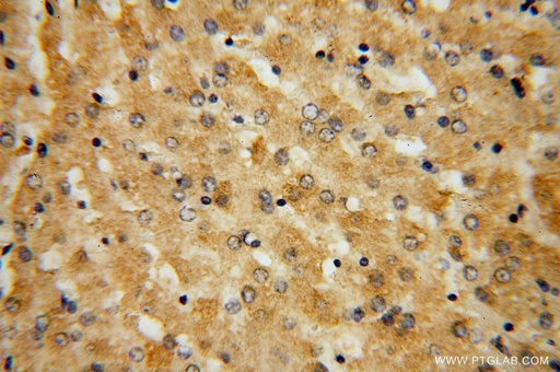 [16209-1-AP-20UL] GGCX Polyclonal antibody