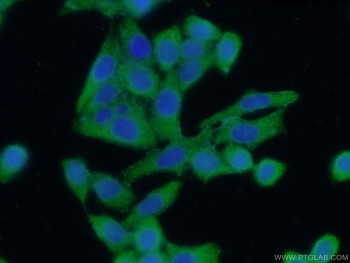 [16210-1-AP-20UL] ASS1 Polyclonal antibody