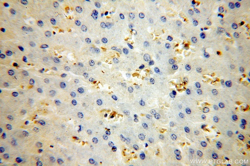 [16216-1-AP-20UL] HBB Polyclonal antibody