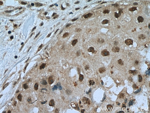 [16230-1-AP-150UL] TINP1 Polyclonal antibody