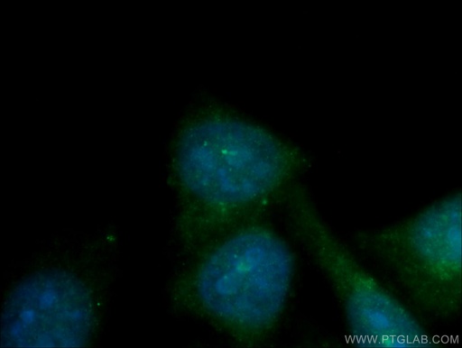 [16280-1-AP-150UL] CEP70 Polyclonal antibody