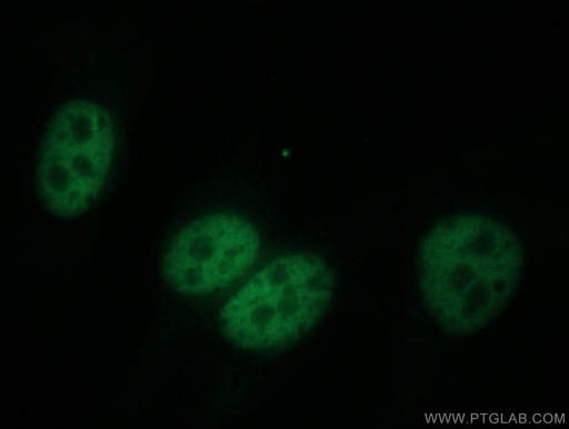 [16281-1-AP-20UL] DPY30 Polyclonal antibody