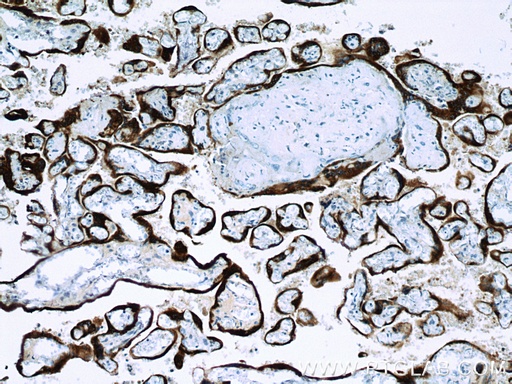 [16326-1-AP-150UL] Placental lactogen Polyclonal antibody