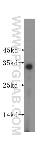 [16348-1-AP-20UL] SULT2A1 Polyclonal antibody