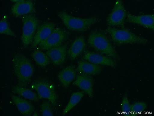 [16352-1-AP-150UL] PSG11 Polyclonal antibody