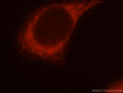 [16369-1-AP-150UL] PIGO Polyclonal antibody