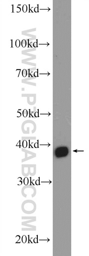 [16392-1-AP-20UL] MRM1 Polyclonal antibody