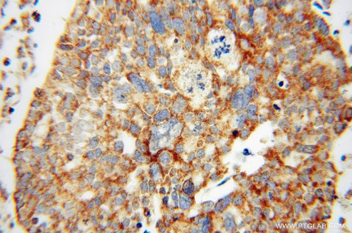 [16394-1-AP-150UL] MRPL44 Polyclonal antibody