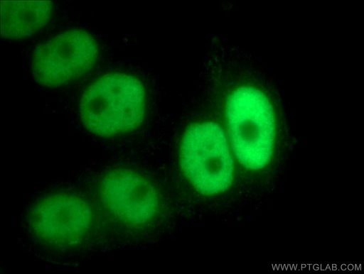 [16399-1-AP-150UL] NFIC Polyclonal antibody