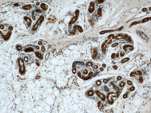[16417-1-AP-150UL] BCAT2 Polyclonal antibody