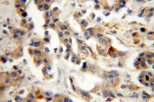 [16442-1-AP-150UL] ST6GALNAC5 Polyclonal antibody