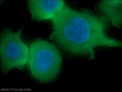 [16488-1-AP-20UL] Villin Polyclonal antibody