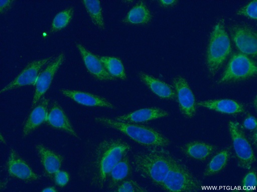 [16501-1-AP-20UL] DNAJB14 Polyclonal antibody