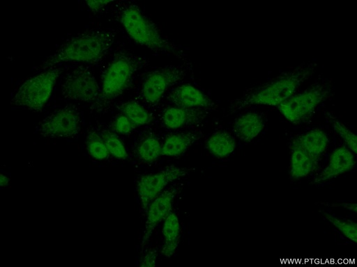 [16511-1-AP-150UL] SUPT5H Polyclonal antibody