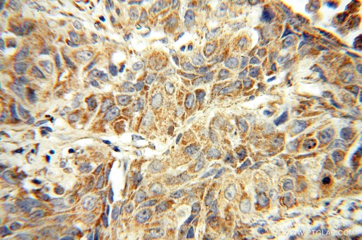 [16514-1-AP-150UL] DUSP22 Polyclonal antibody