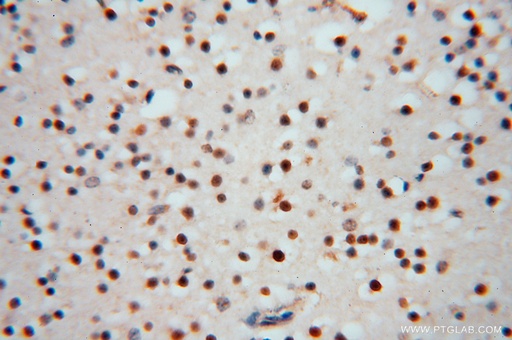 [16518-1-AP-150UL] RNASEH2C Polyclonal antibody