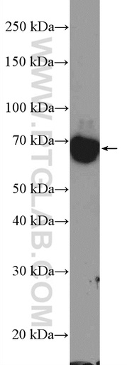 [16540-1-AP-20UL] TOP1MT Polyclonal antibody
