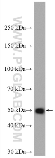 [16551-1-AP-20UL] GLI4 Polyclonal antibody