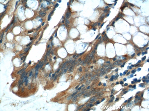 [15849-1-AP-20UL] NDUFS4 Polyclonal antibody