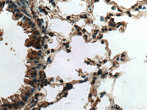 [15856-1-AP-20UL] CYTL1 Polyclonal antibody