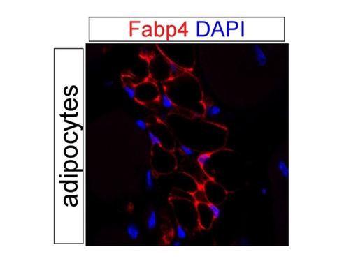 [15872-1-AP-20UL] FABP4 Polyclonal antibody