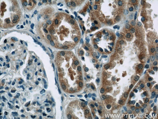 [15887-1-AP-20UL] EIF1, EIF1B Polyclonal antibody