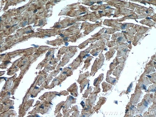 [15891-1-AP-20UL] CKM/CKB Polyclonal antibody