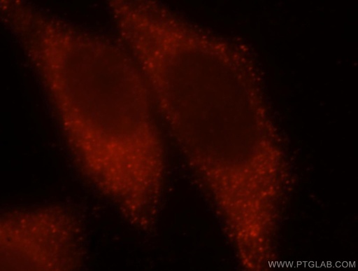[15894-1-AP-20UL] CALML4 Polyclonal antibody