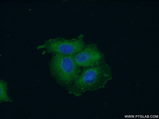 [15897-1-AP-150UL] SH3GLB2 Polyclonal antibody