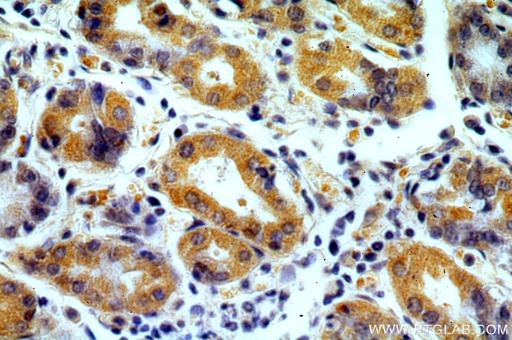 [15907-1-AP-20UL] MRPS2 Polyclonal antibody