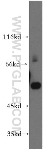 [15926-1-AP-150UL] QRSL1 Polyclonal antibody