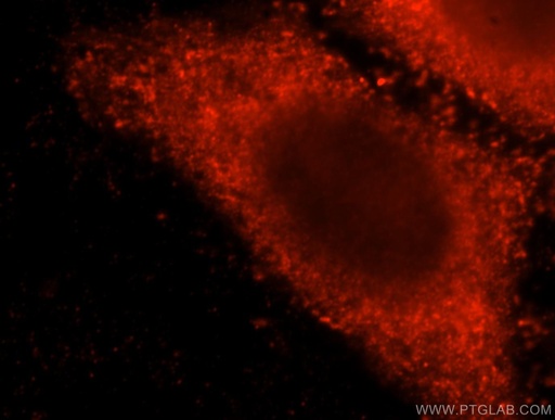 [15938-1-AP-20UL] CNOT10 Polyclonal antibody