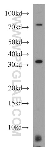 [15951-1-AP-150UL] MED4 Polyclonal antibody