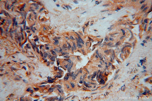 [15970-1-AP-150UL] IMMP2L Polyclonal antibody