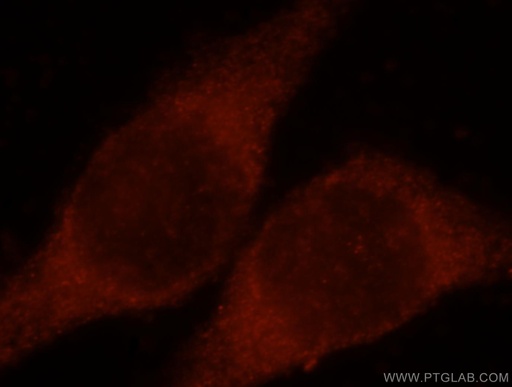 [15971-1-AP-20UL] CLIC3 Polyclonal antibody